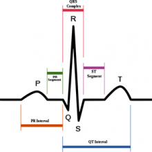 心电图显示心脏正常窦性心律示意图(附英文标签)。