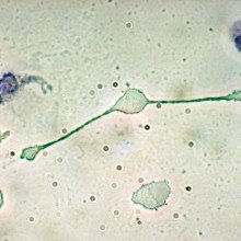 巨噬细胞形成两个过程来吞噬两个较小的颗粒，可能是病原体