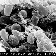 扫描电子显微图描绘了大量的Yersinia pestis bacteria (the cause of bubonic plague) in the foregut of the flea vector