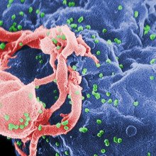 绿色的HIV病毒从淋巴细胞中出芽