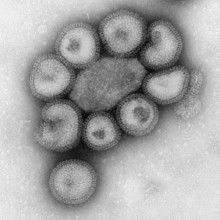 一小群流感病毒或病毒