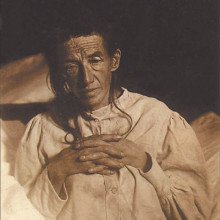 阿洛伊斯·阿尔茨海默氏症患者奥古斯特·皮特在1902年的照片。她是第一个被描述为阿尔茨海默病的病例。