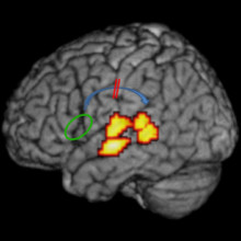连接大脑额叶和颞叶语言区(蓝色部分)的弓形神经束在阅读障碍患者中受损。(图片来源:鲁汶大学Bart Boets)。