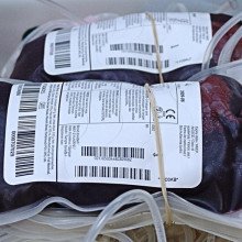 捐献时收集的袋装血液，呈深静脉血。