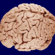 研究人员使用功能性磁共振成像(fMRI)来揭示情绪状态下的大脑活动。图片来源:Inge Volman et al。