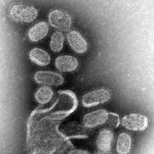 电镜下的流感病毒。正黏液病毒具有多形性(可变)颗粒，周围是布满病毒蛋白的脂质包膜。