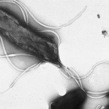 带有多个鞭毛的幽门螺杆菌电子显微镜照片(阴性染色)