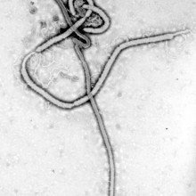 电子显微镜下的埃博拉病毒。埃博拉病毒是丝状病毒家族的一员。管状“牧羊人的弯”状颗粒直径一般为80nm，最长可达1000nm。