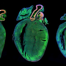 用对照microRNA(左)或两个人类microRNA处理新生大鼠心脏，强烈增加心肌细胞增殖(中、右)。图中显示左侧肌肉团中有几个正在复制的(红色)细胞。