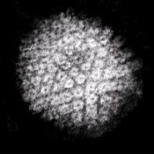 HSV粒子的电子显微照片