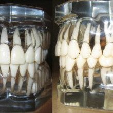 人类牙齿的模型，因为他们存在于牙槽骨。