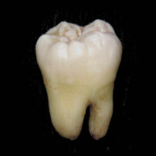 人类的牙齿