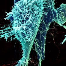 在这张电子显微照片中，线状埃博拉病毒颗粒正在从受感染的细胞中脱落