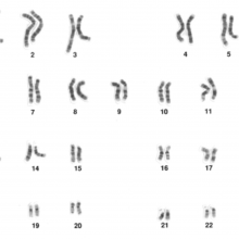 人类男性的核型——显示了构成人类基因组的全部23对染色体。不是“XY”性染色体，表明这个人是男性。