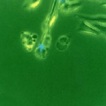 携带激光束(蓝色)的纳米传感器探针穿透活细胞，以检测表明细胞已暴露于致癌物质的产物的存在。
