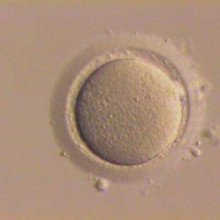 剥离的人卵母细胞(卵细胞);卵母细胞周围的颗粒细胞已被去除。
