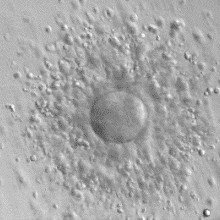 人卵母细胞(卵细胞)和周围的颗粒细胞