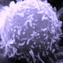 单个人淋巴细胞的电子显微镜图像。