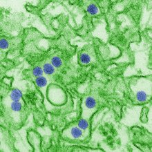 数码彩色透射电子显微照片(TEM)寨卡病毒，这是黄病毒科的成员。病毒颗粒，这里是蓝色的，直径40纳米，有一个外包膜，和一个内部致密的核。